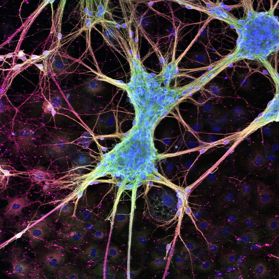 Microscopic neuron cell image